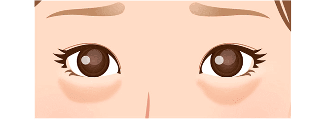 A-CRF瀬術流れ