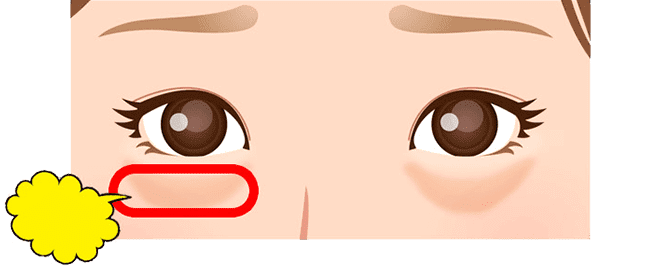 A-CRF瀬術流れ