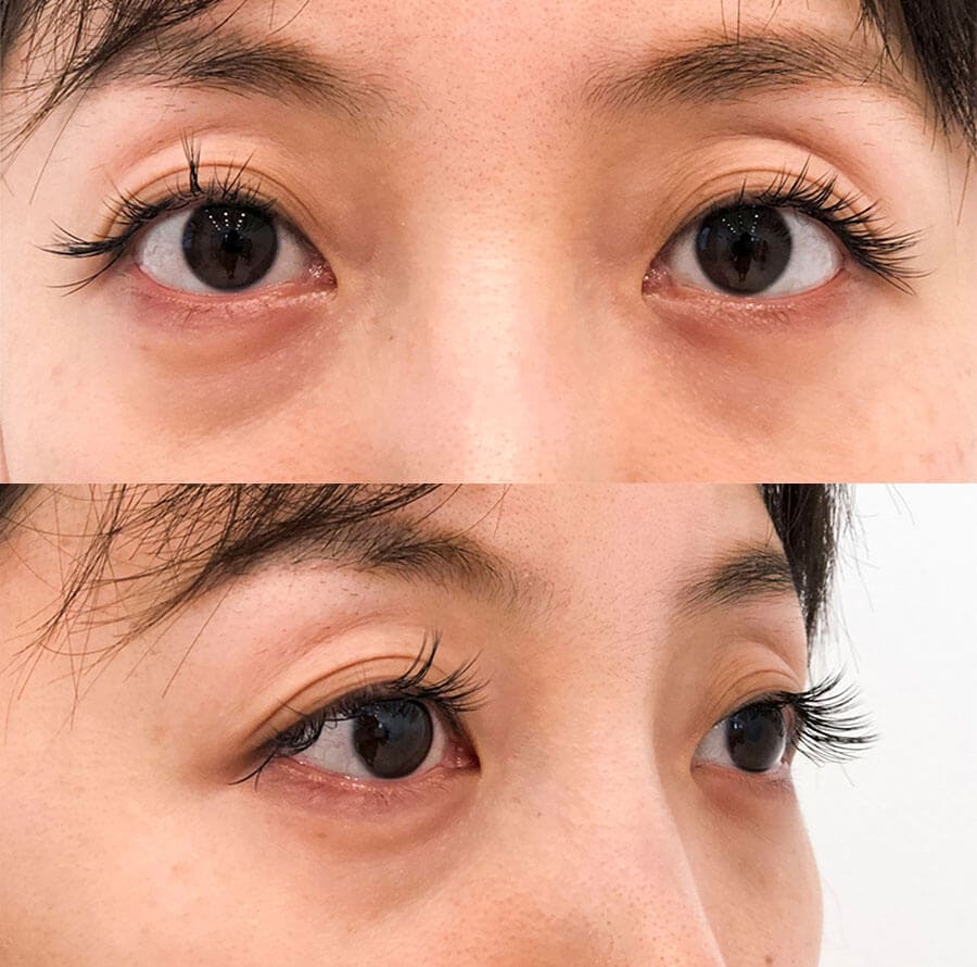 Before