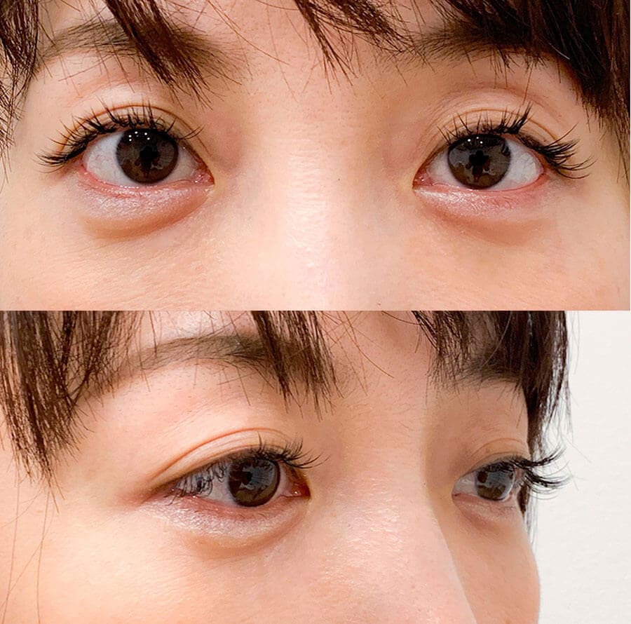 After