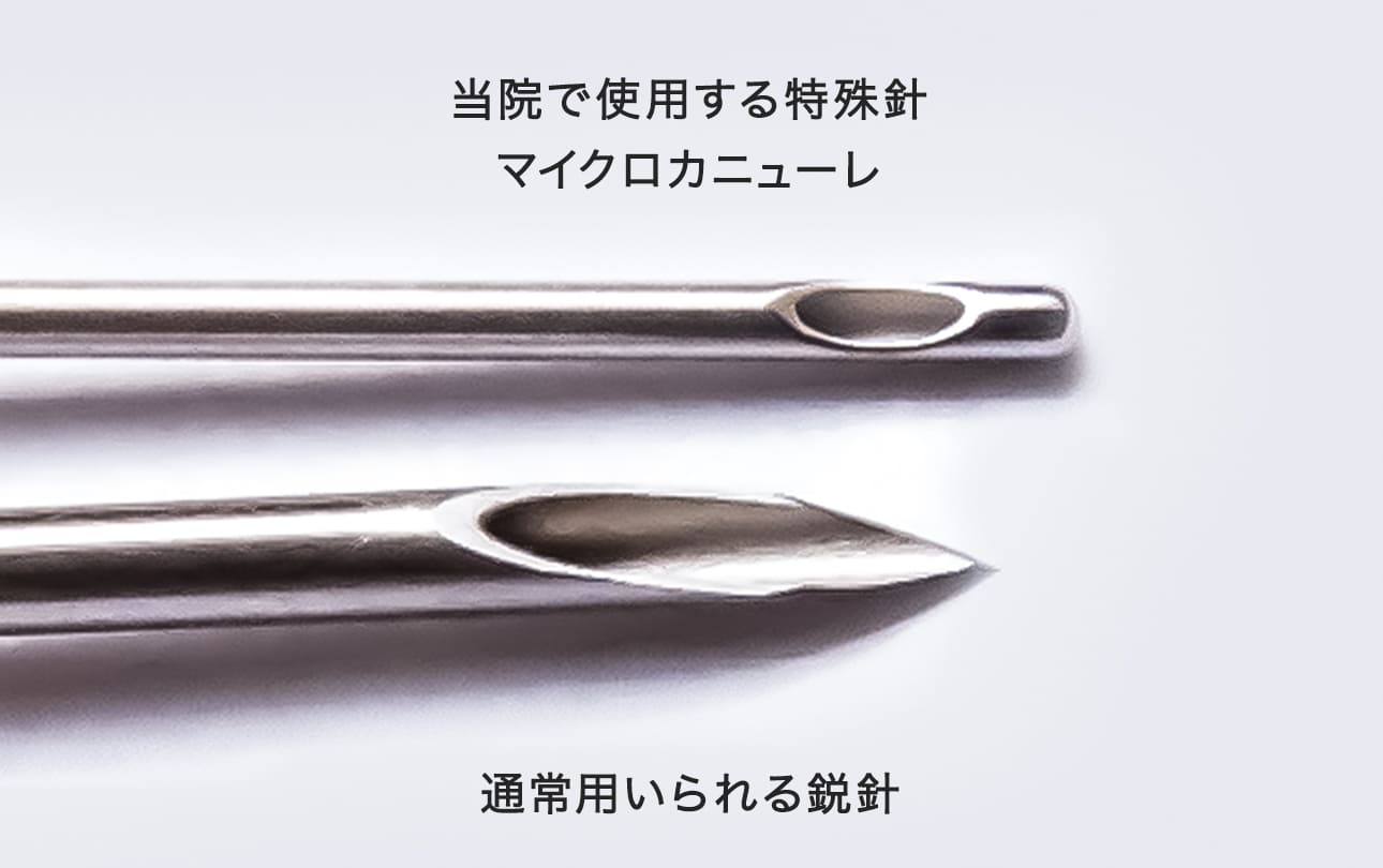 痛みが少なくダウンタイムも最小限