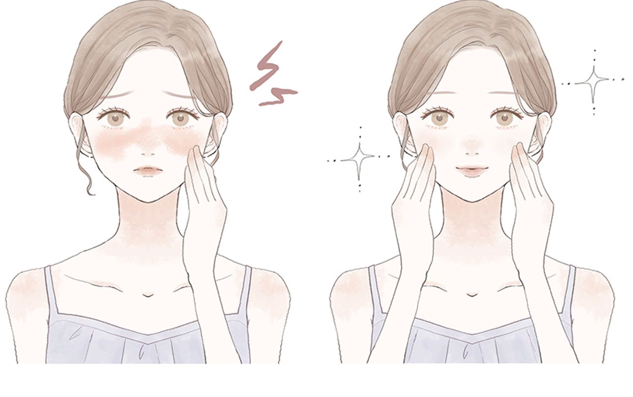 酒さなどの赤ら顔を改善