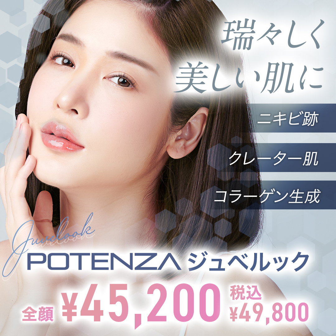 ポテンツァ ジュベルックキャンペーン