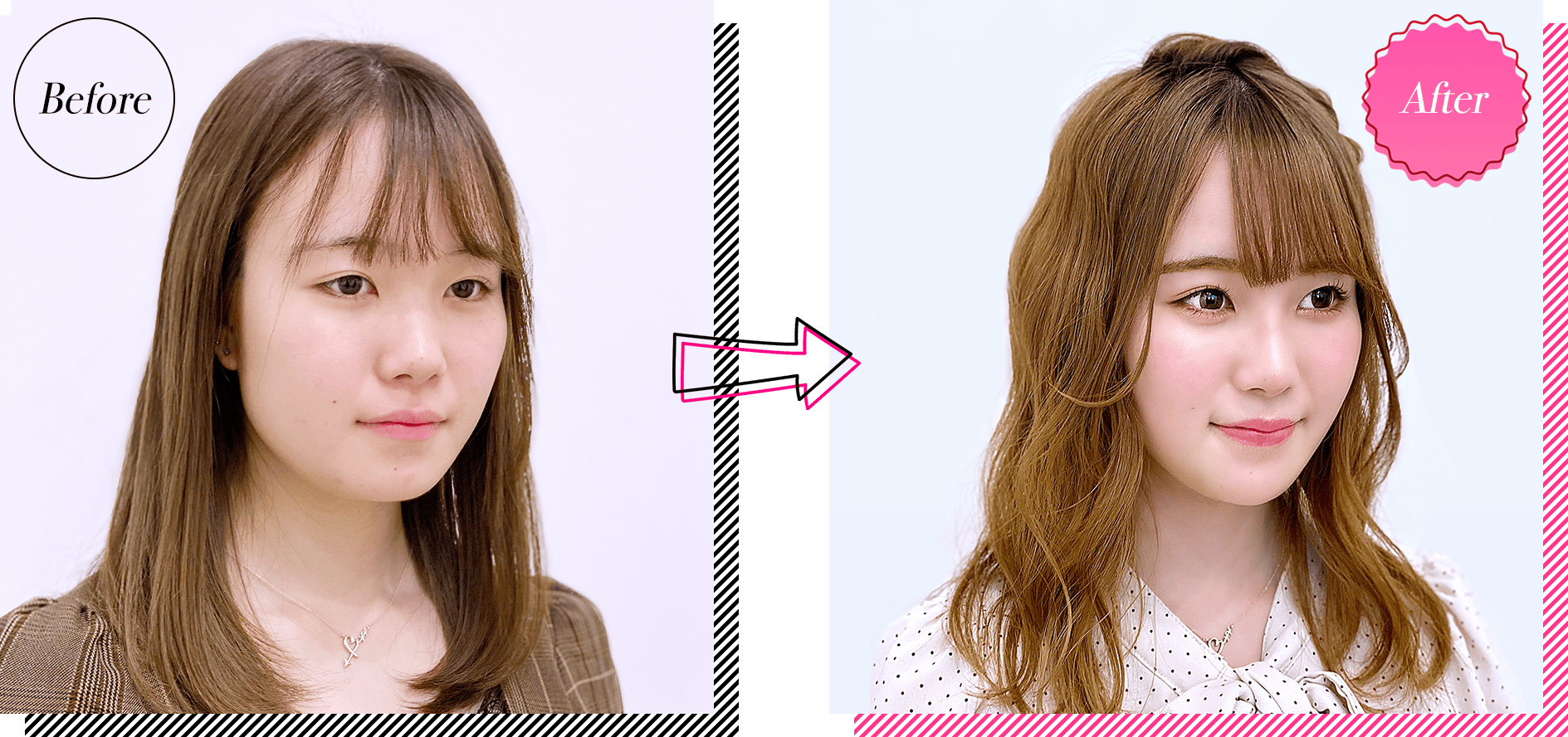 シンデレラモニター症例写真 斜め左