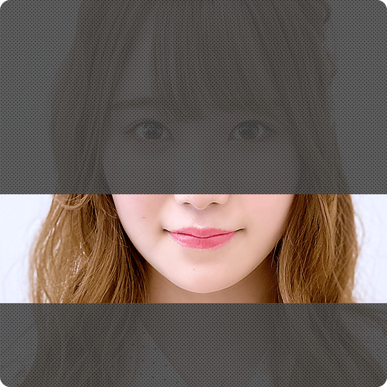 フェイスラインのメニュー 症例写真
