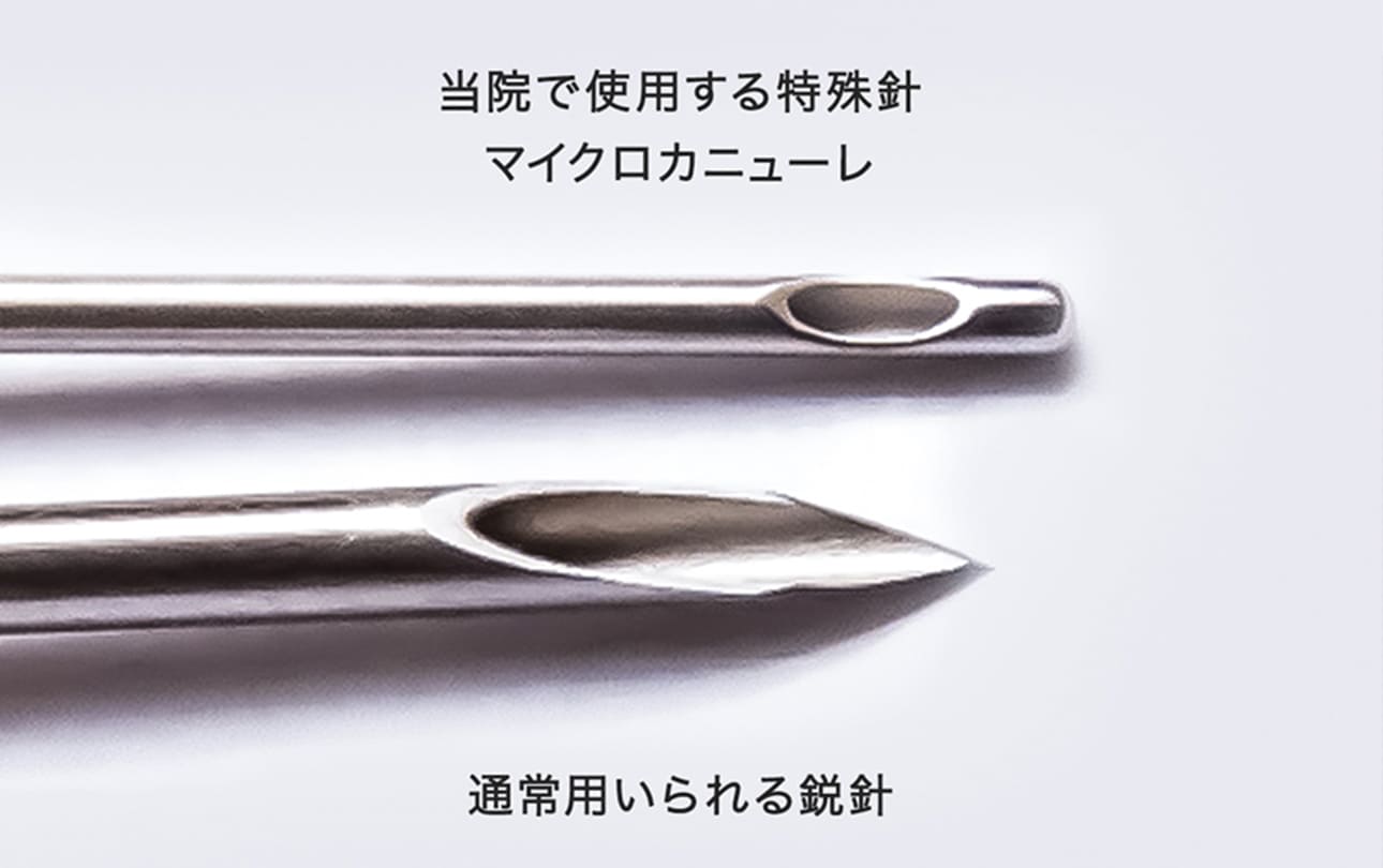 マイクロカニューレ(極細針)が無料