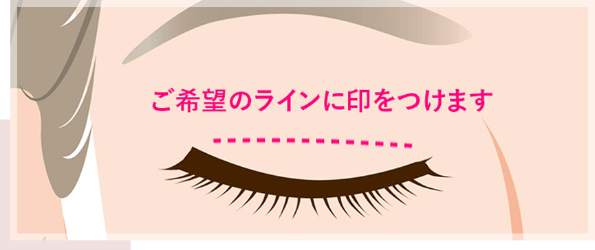 ご希望のラインに印をつけます