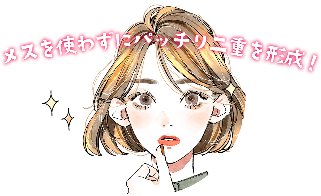 メスを使わずにバッチリ二重を形成