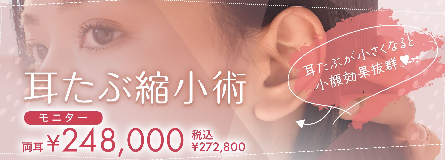 耳たぶ縮小術モニター
