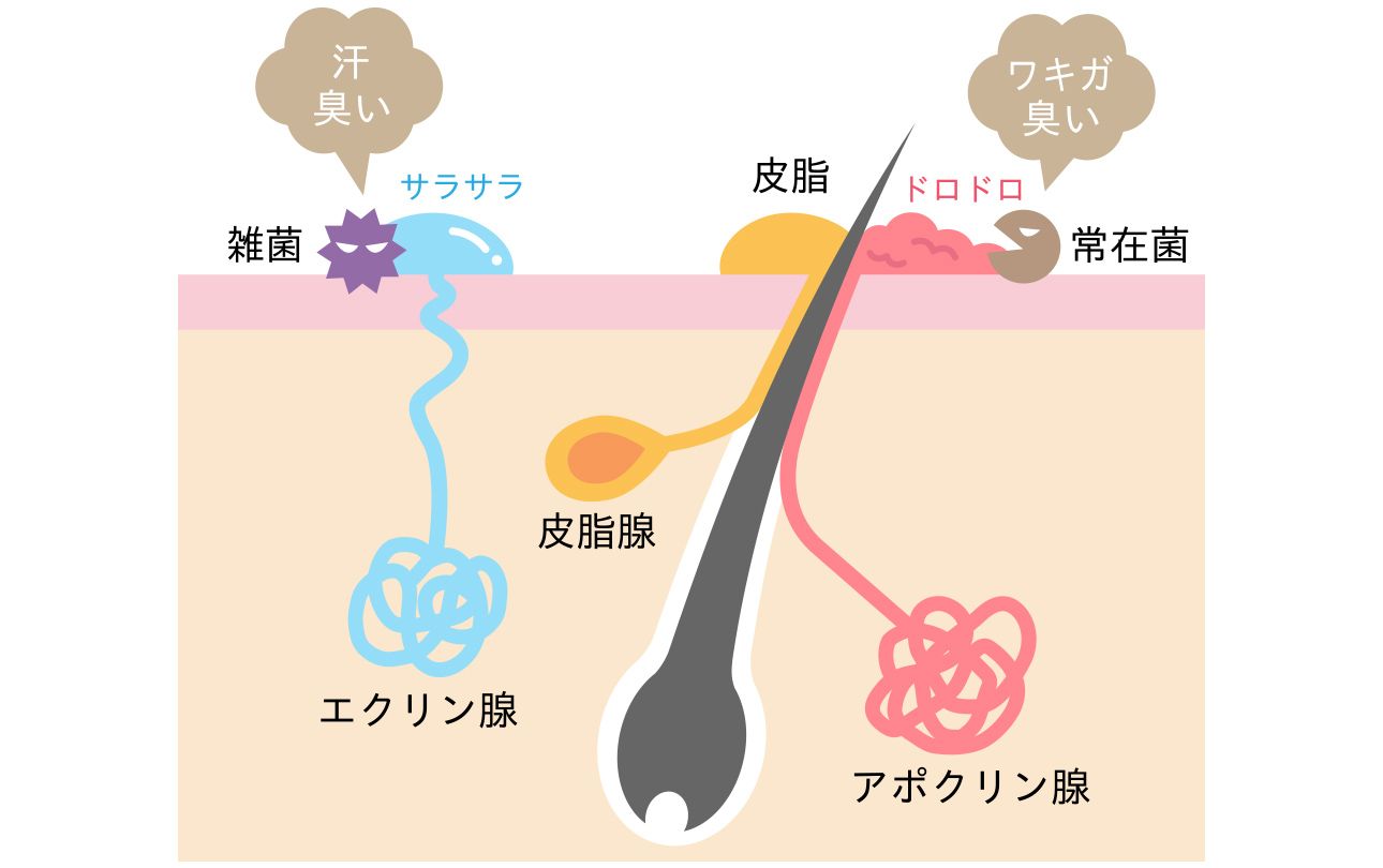 フェムボトックス(すそわきが)