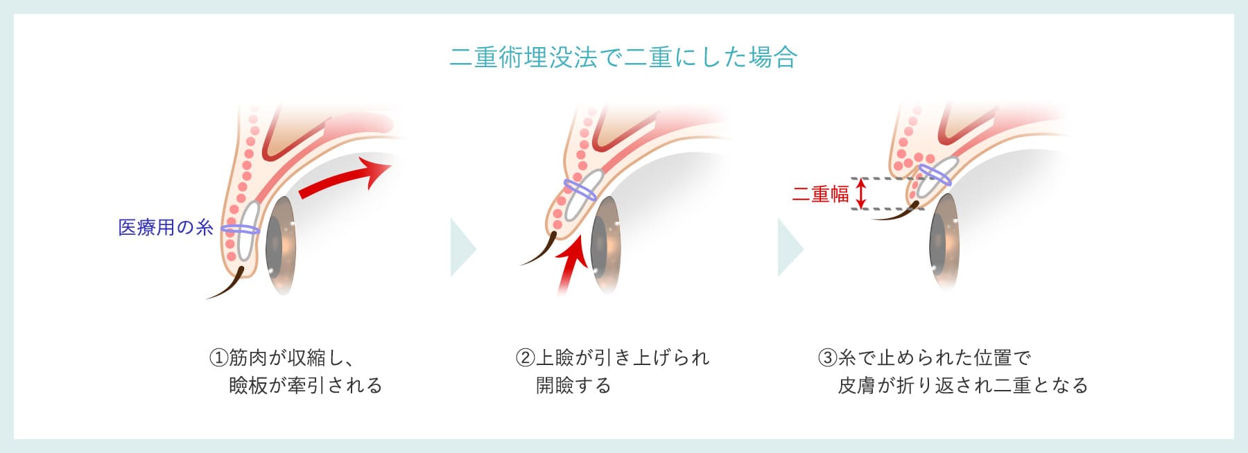 まぶたの構造