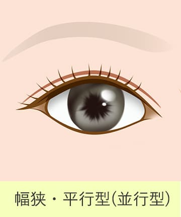 二重の種類