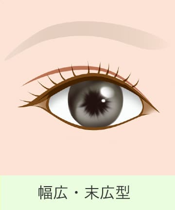 二重の種類