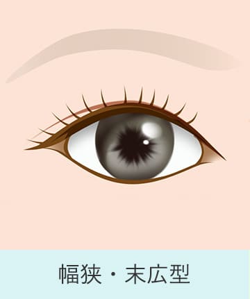 二重の種類