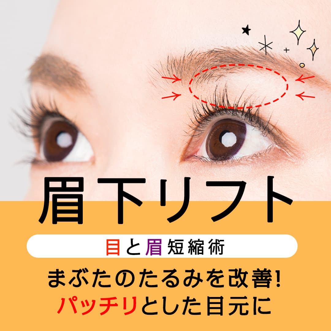 眉下リフト