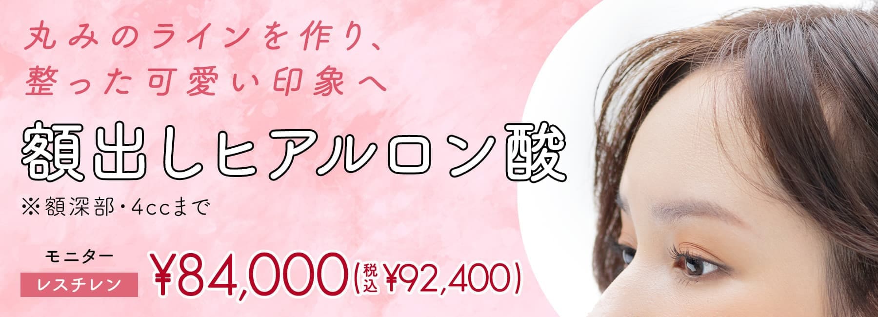 額出しヒアルロン酸注入モニター募集