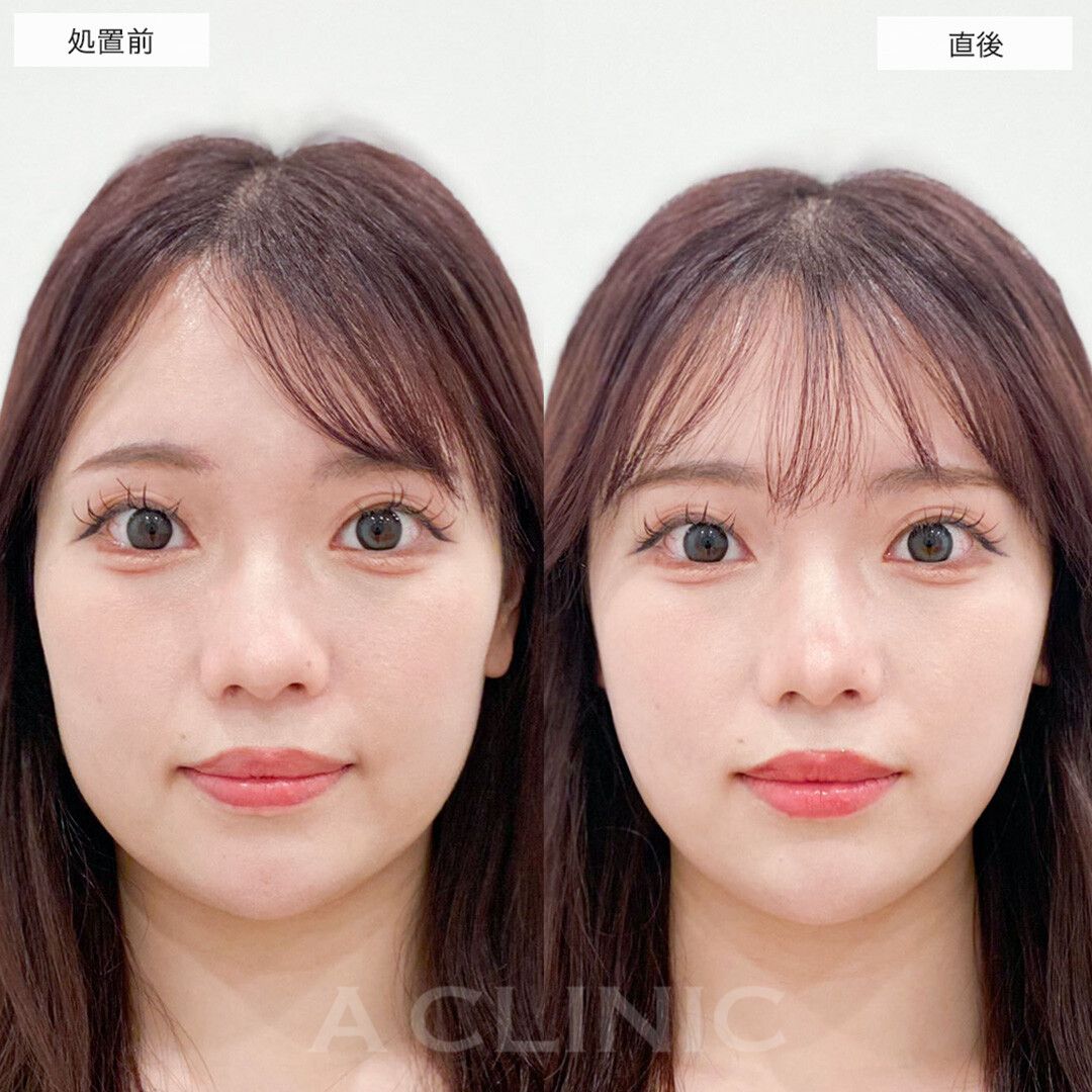 Aスレッド®︎