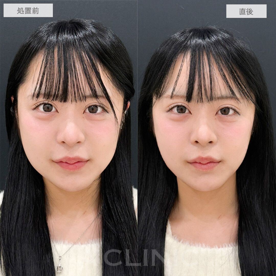 Aスレッド®︎