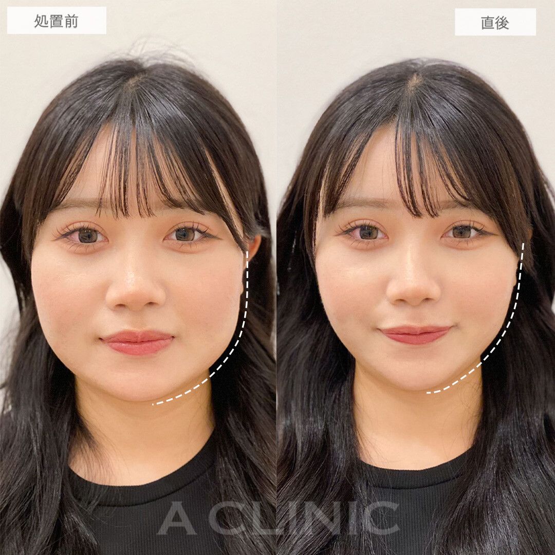 Aスレッド®︎