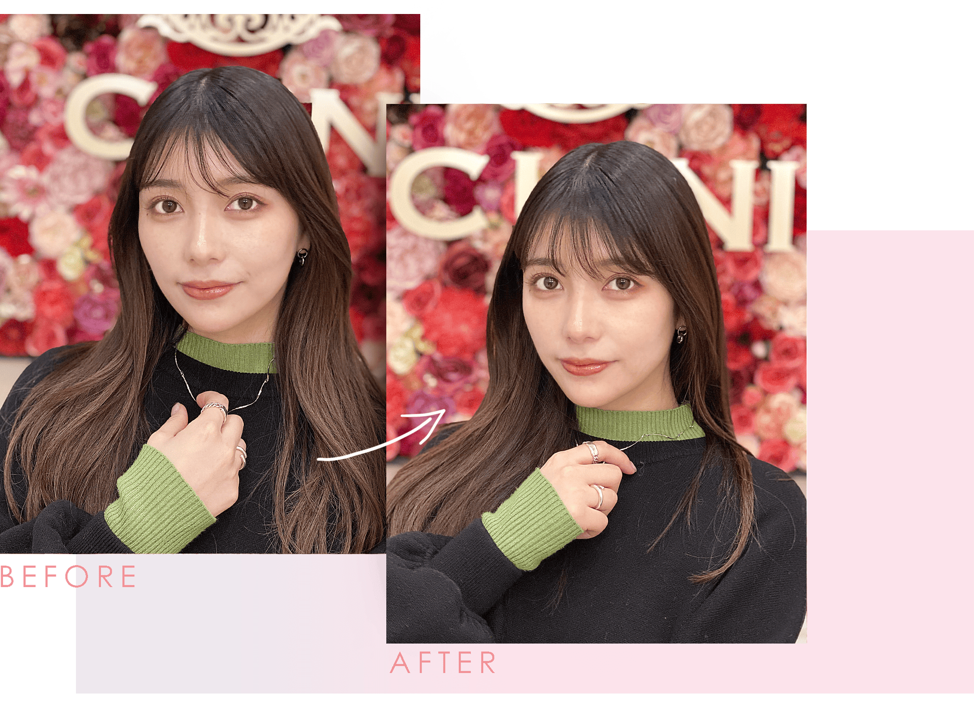 Aスレッド症例写真 ビフォーアフター