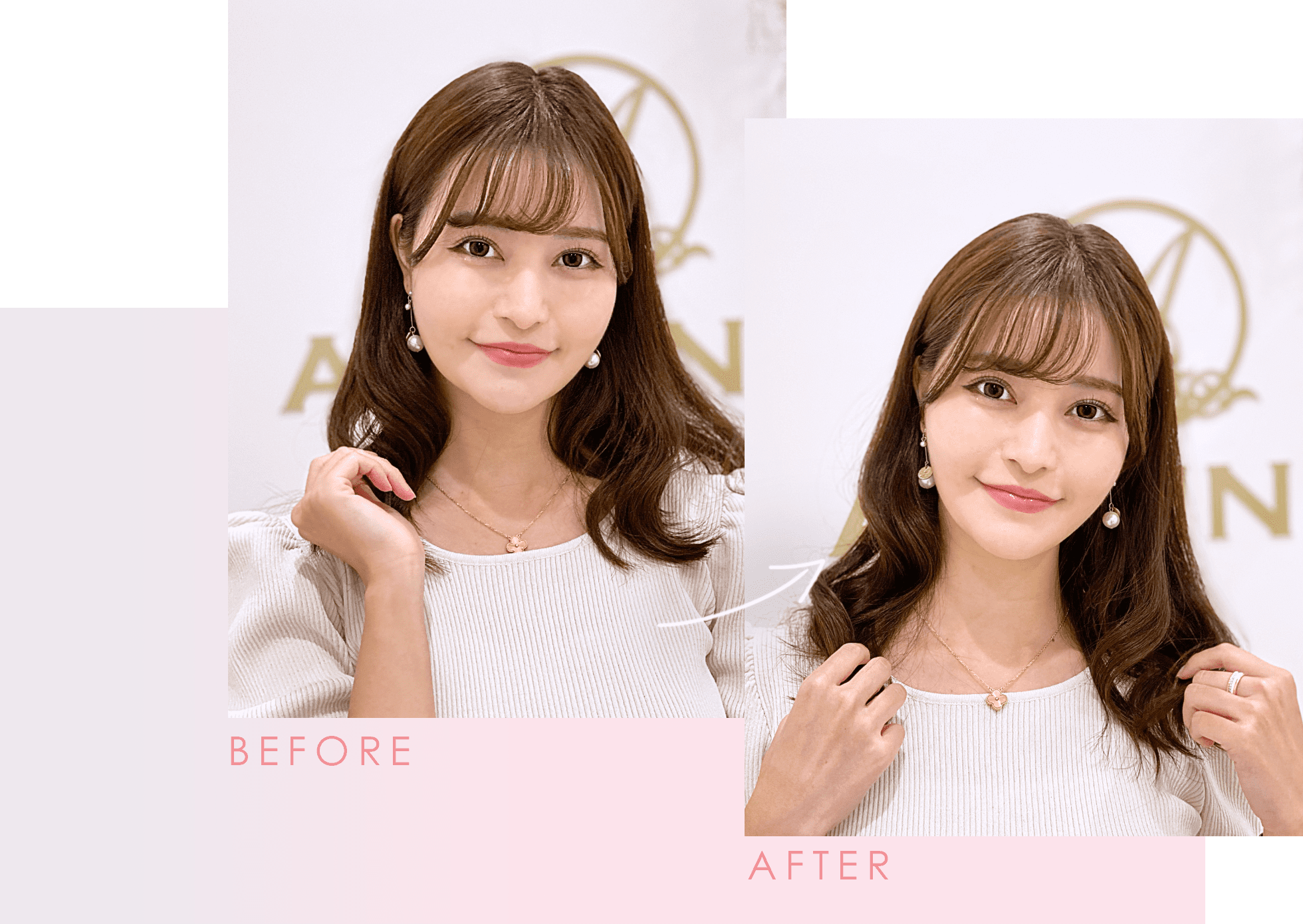 Aスレッド症例写真 ビフォーアフター