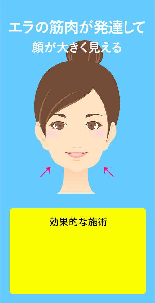 エラの筋肉が発達して顔が大きく見える