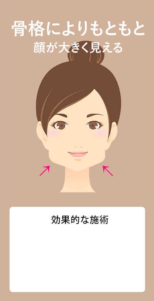 骨格によりもともと顔が大きく見える