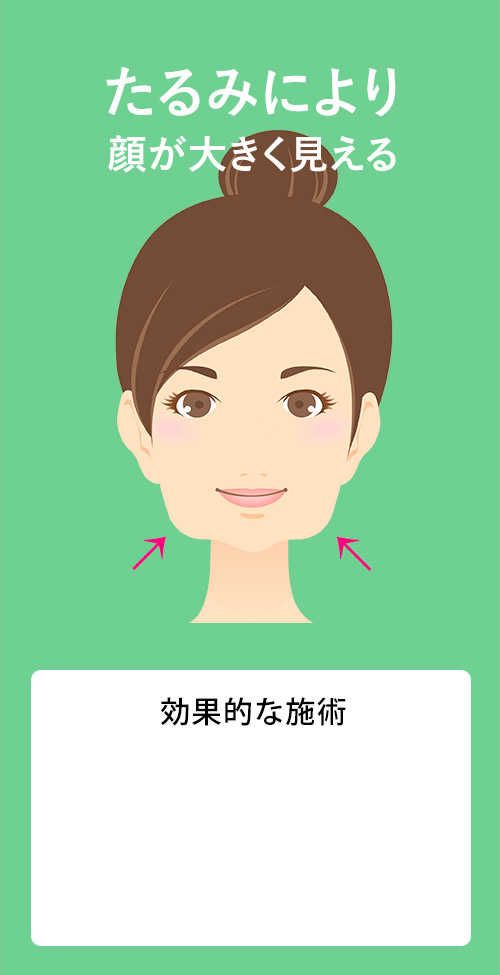 たるみにより顔が大きく見える
