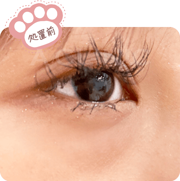 症例写真befor02