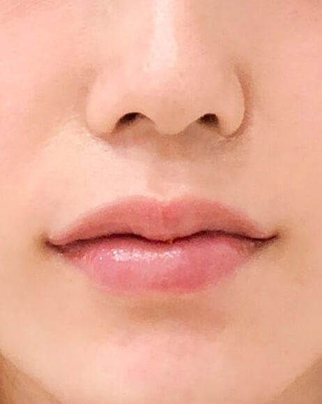 After