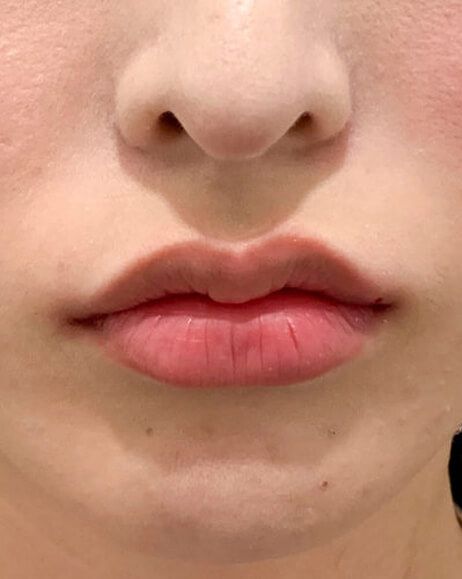After
