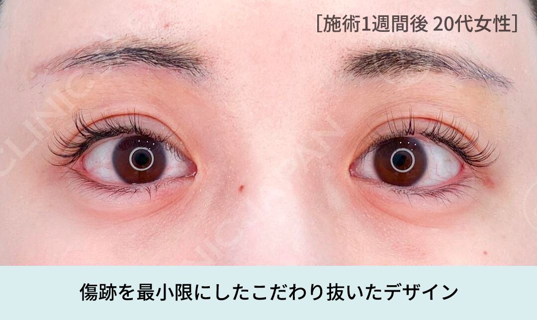 ACLINICのこだわり