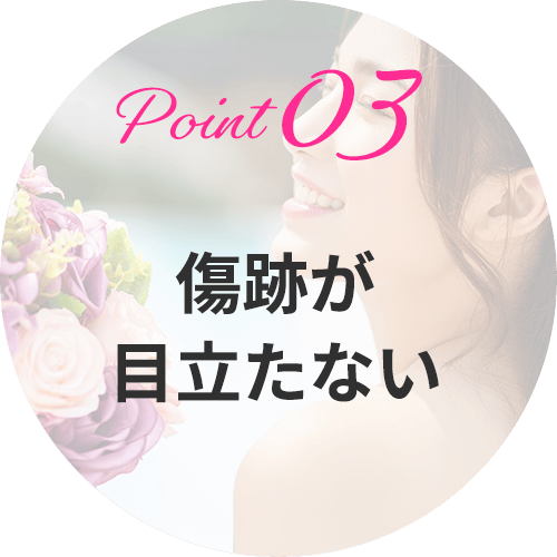 眉下リフト