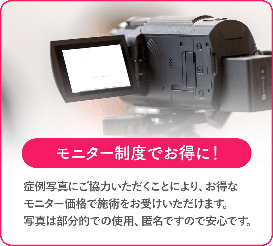 モニター制度でお得に！