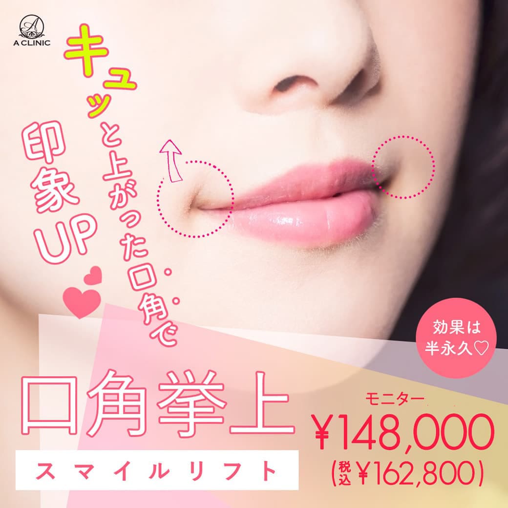 口角挙上スマイルリフト