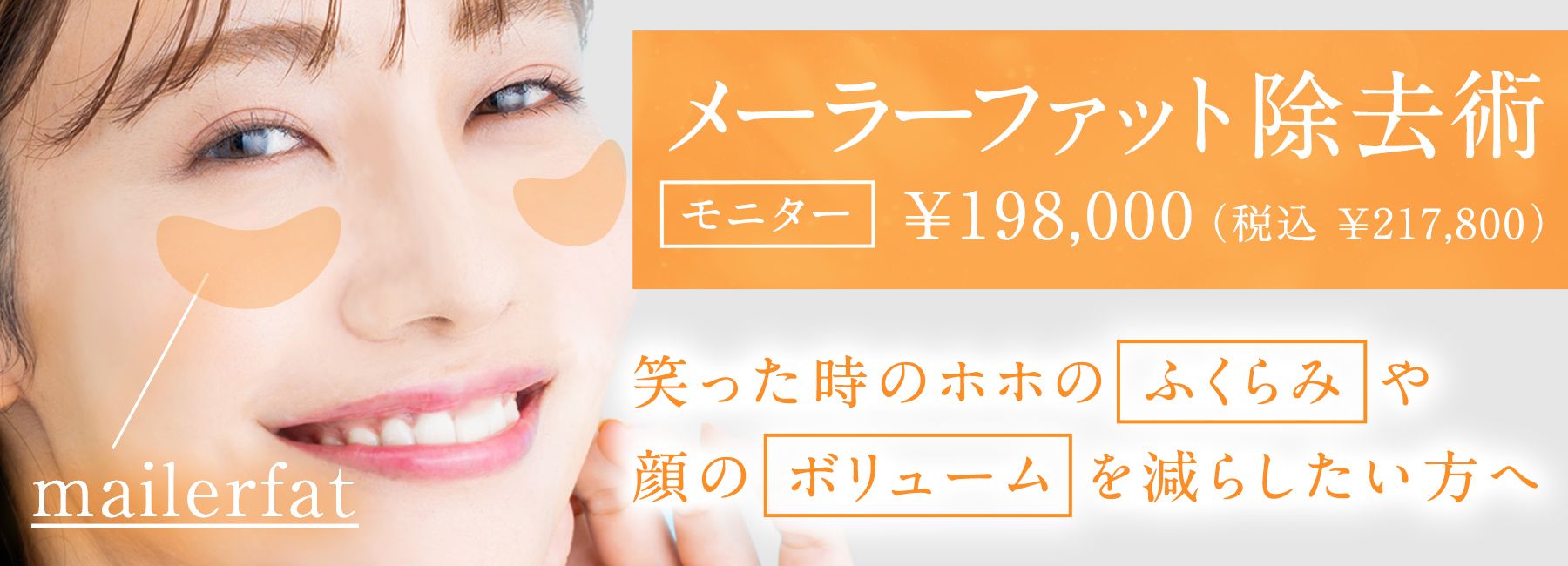 モニター募集