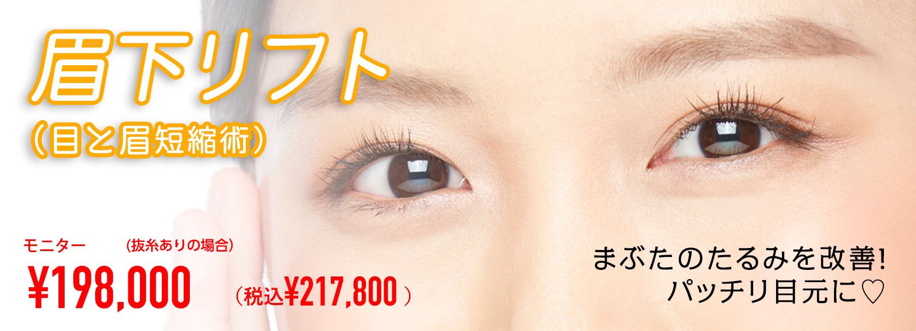 眉下リフトモニター募集