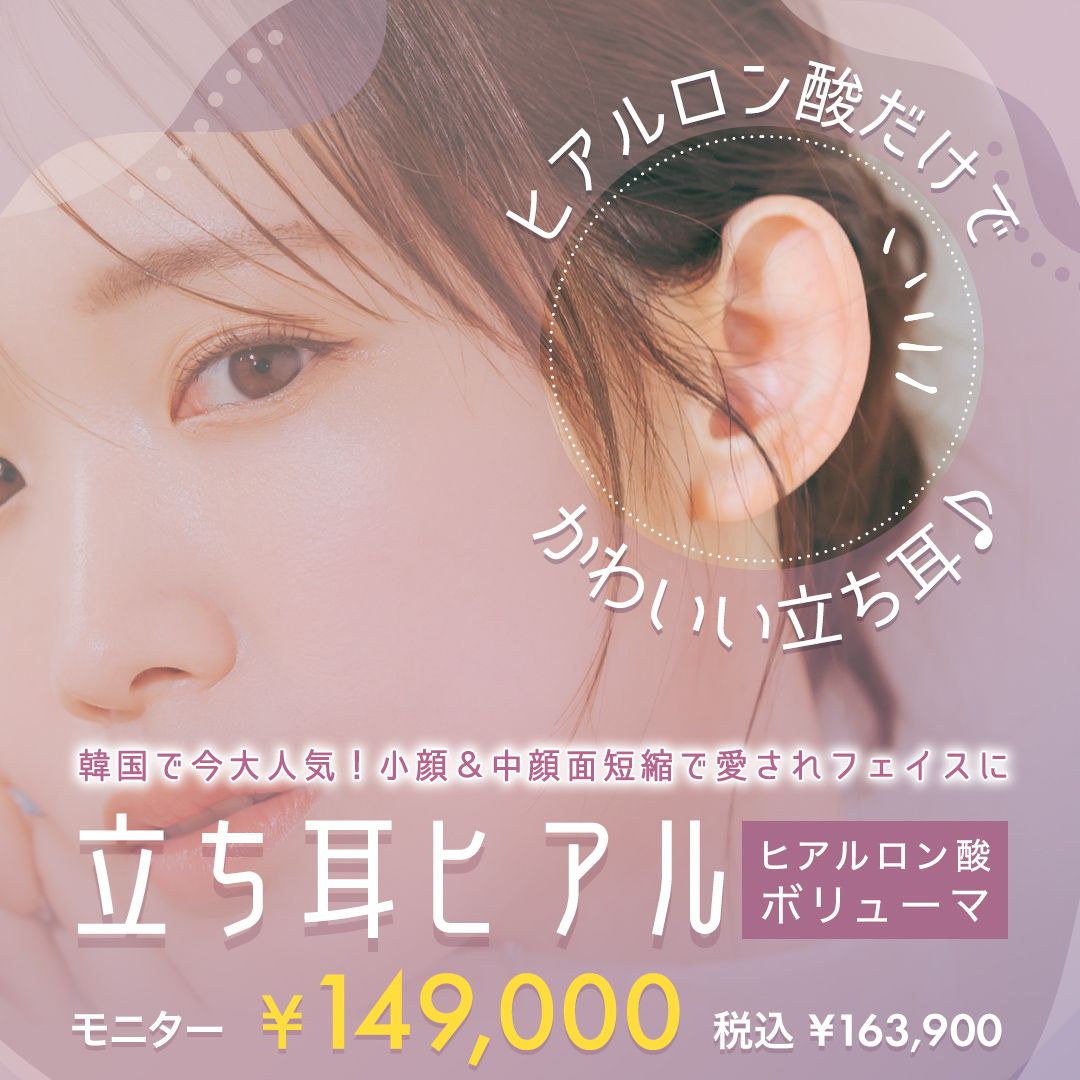 立ち耳ヒアルロン酸注入(ボリューマ)モニター