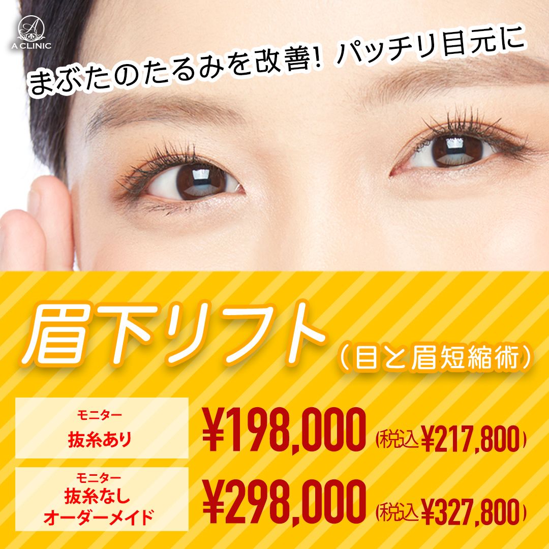 眉下リフト