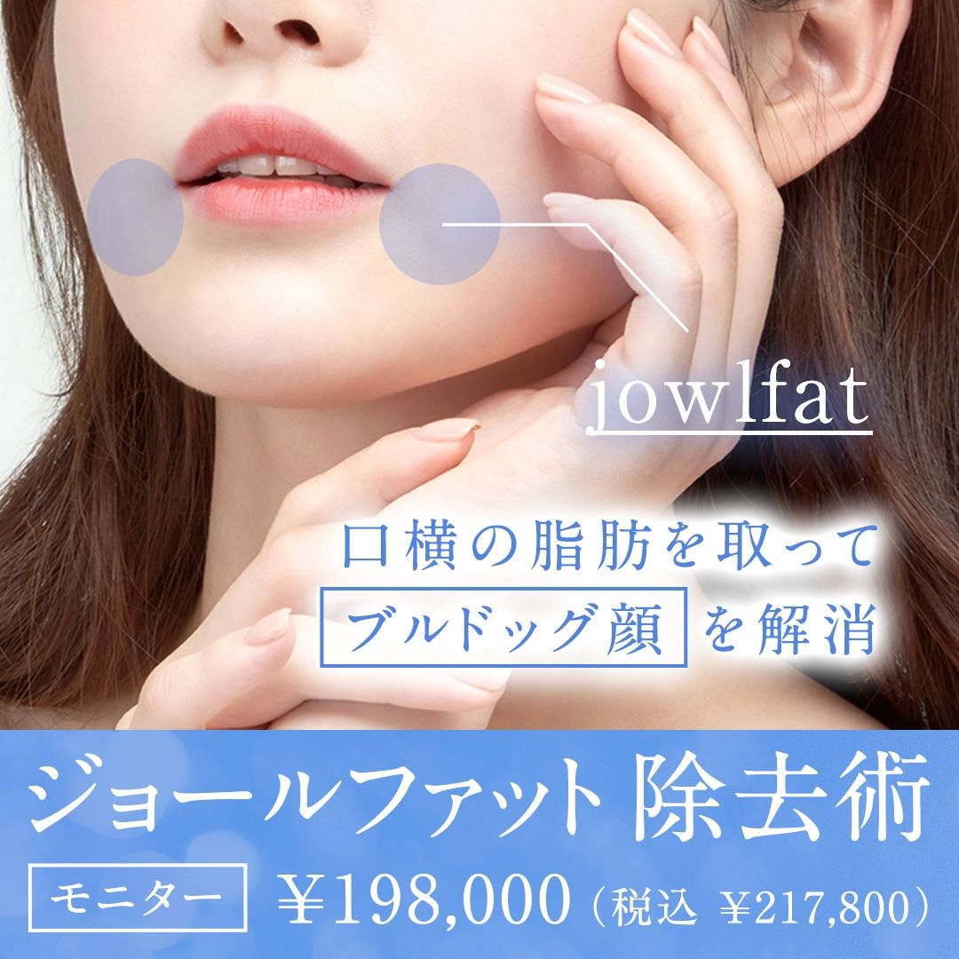 ジョールファット除去術モニター