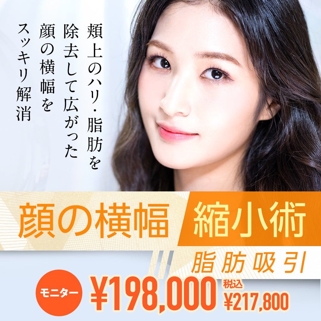 顔の横幅縮小術(脂肪吸引)モニター