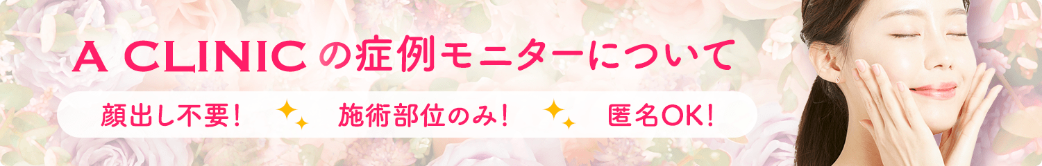 モニターFAQ