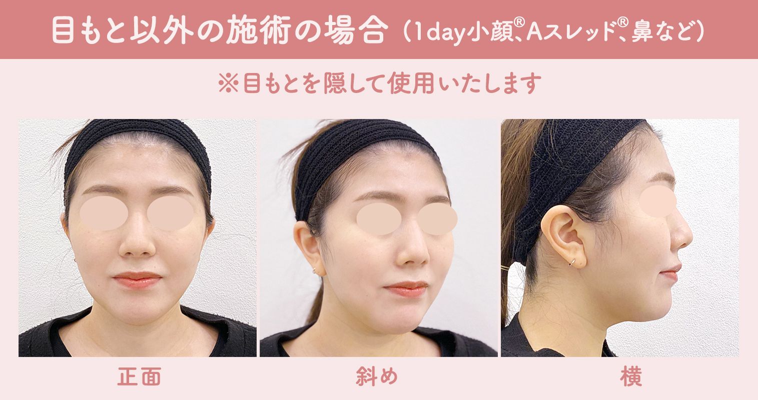 目もと以外の施術の場合(1day小顔、Aスレッド、鼻など)