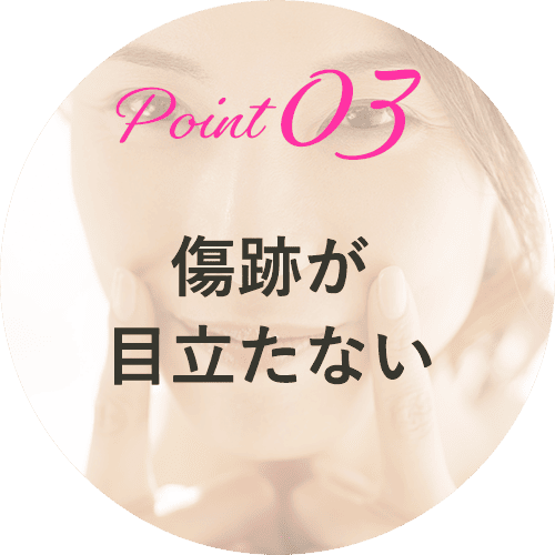 人中短縮術
