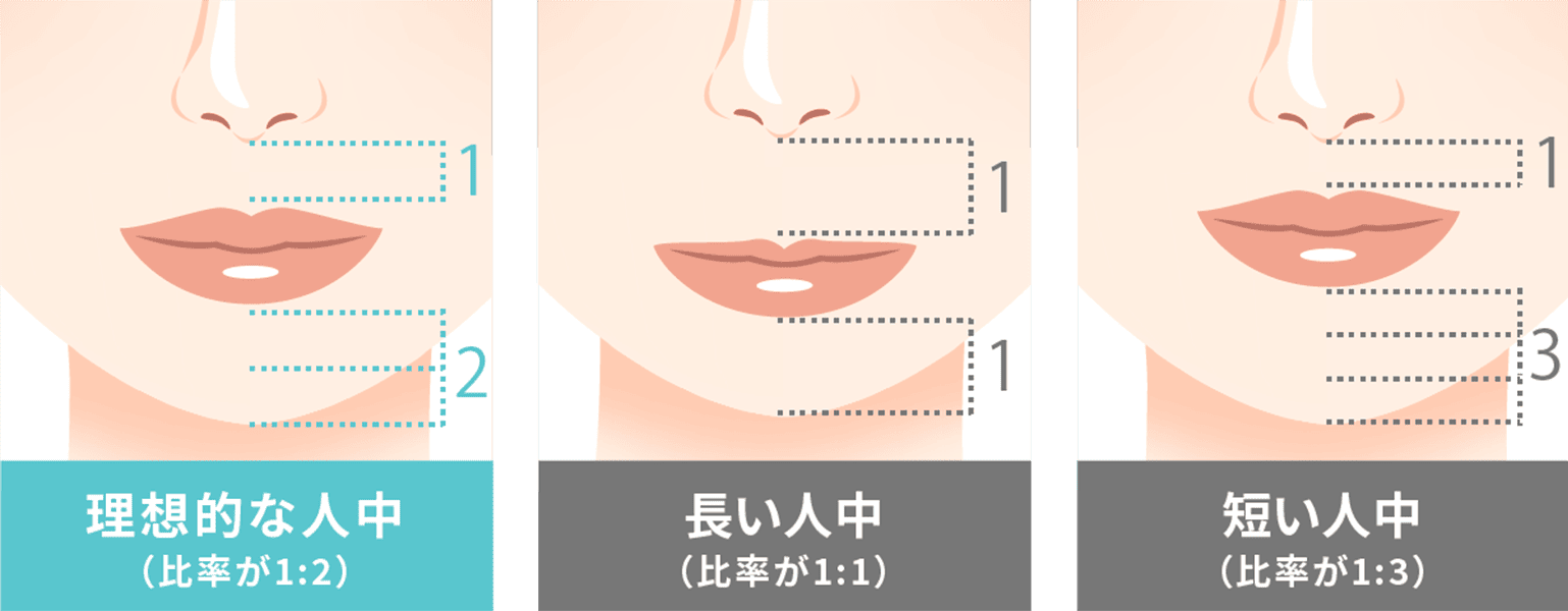 人中短縮術改善効果