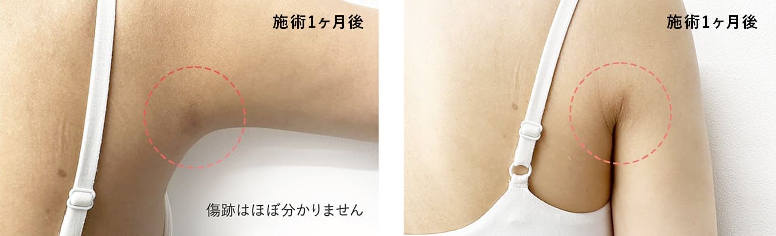 A CLINICメソッド