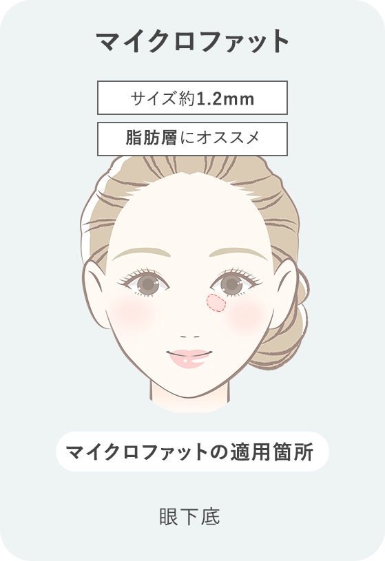 脂肪注入LIPOCUBE