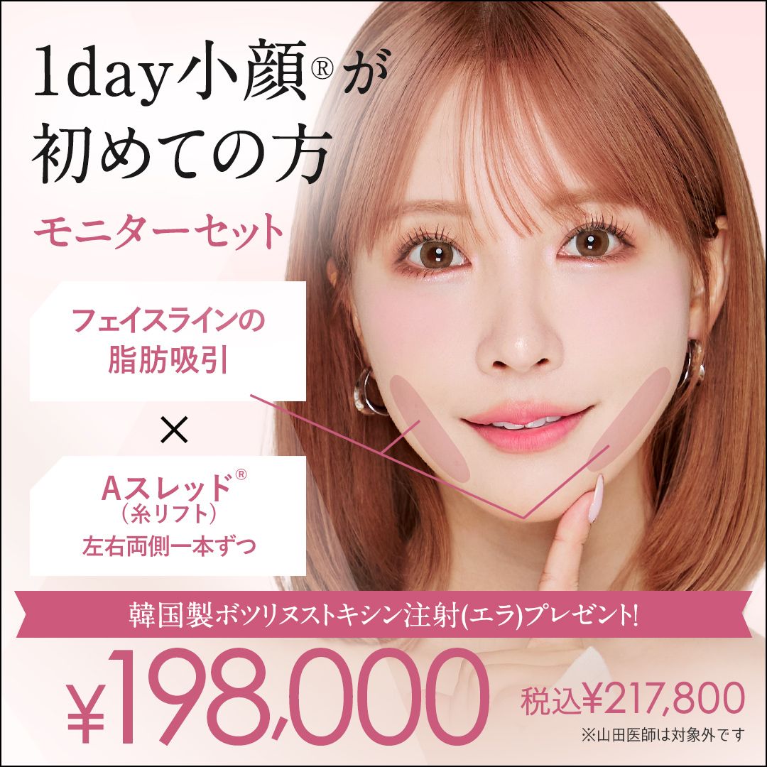 1day小顔脂肪吸引（頬・輪郭・顎下・エラ下）の症例モニター募集