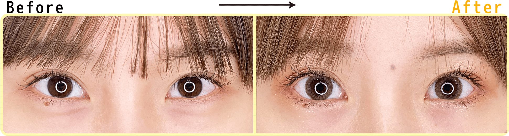 パーフェクトアイズ症例写真3