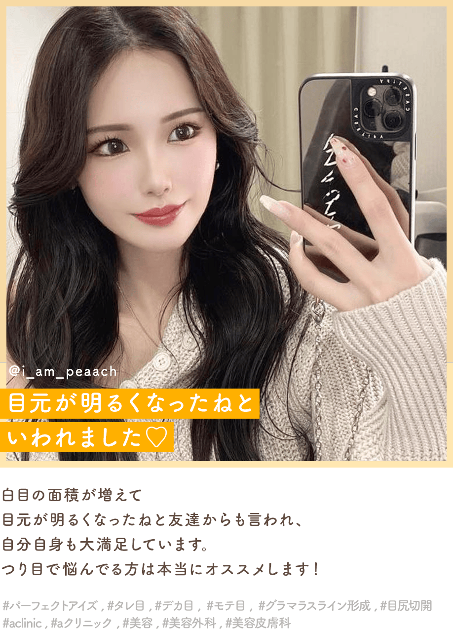 パーフェクトアイズインフルエンサー1